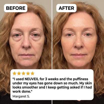 NEUVEIL Microneedle Eye Patches